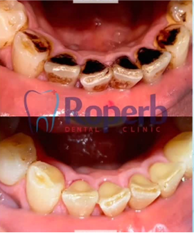 Roperb Dental Clinic