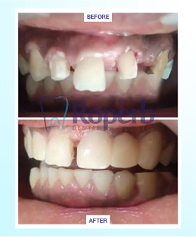 Roperb Dental Clinic