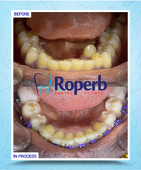 Roperb Dental Clinic